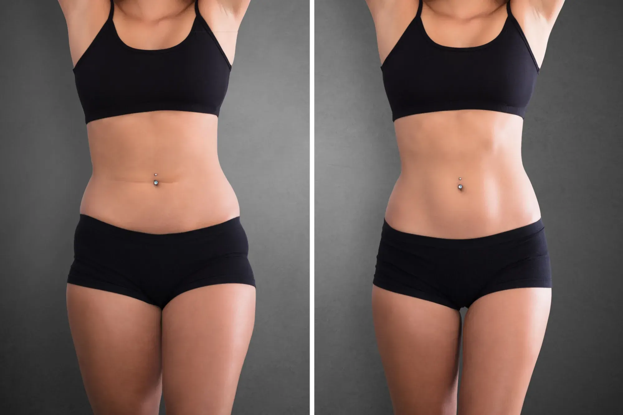 Weight Management Program (GLP-1) - Before and After