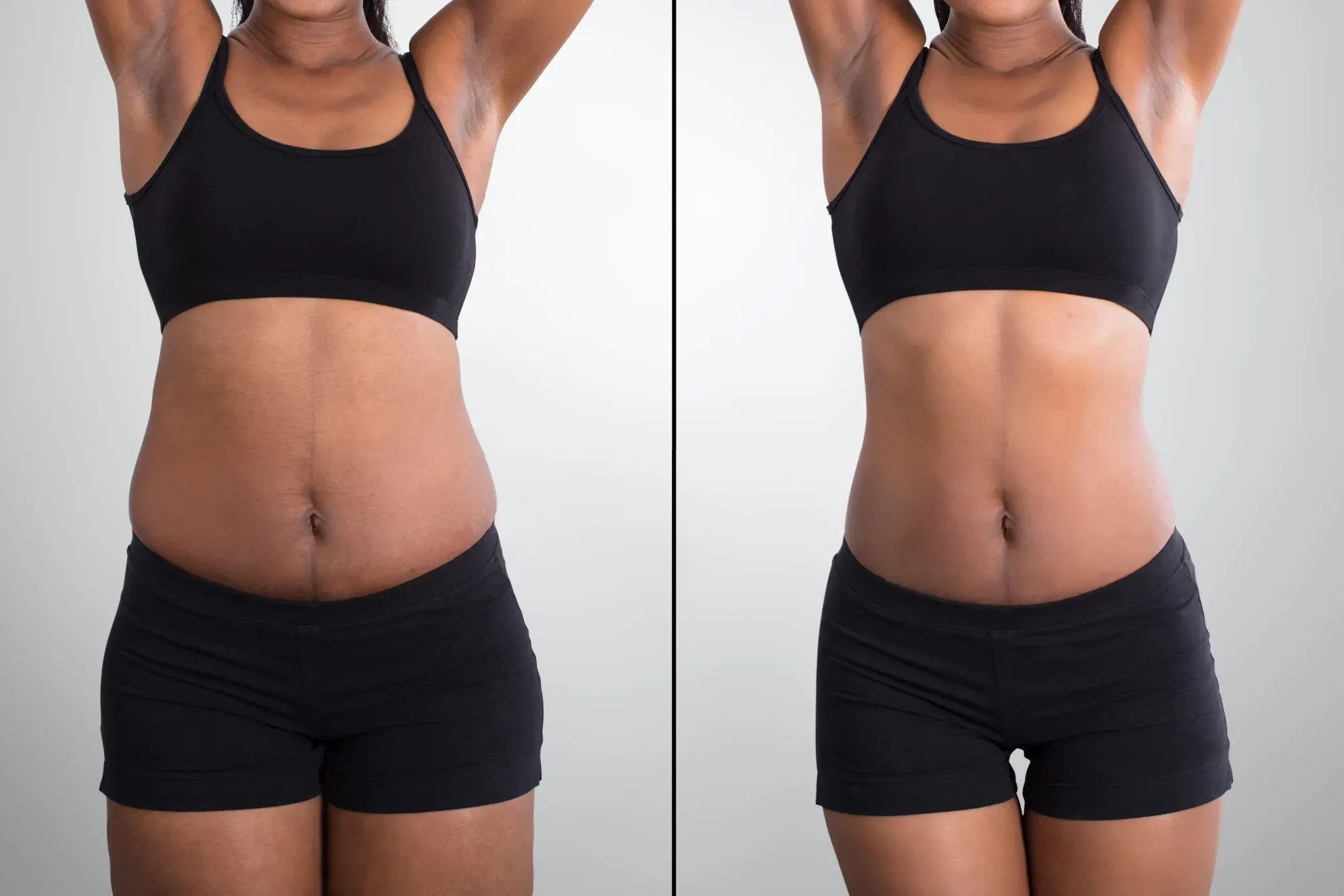 Weight Management Program (GLP-1) - Before and After